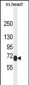 NGFR Antibody